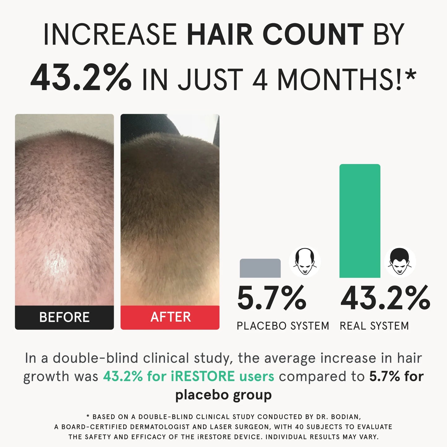 A diagram showing a before and after photo of a man and bar graph showing the clinical study result conducted to evaluate the safety and efficacy of the iRESTORE device. Increase hair count by 43.2% in just 4 months. In a double-clinical study, the average increase in hair growth was 43.2% for iRESTORE users compared to 5.7% for placebo group.